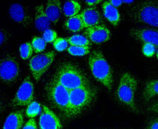 ICC staining of Calponin in HepG2 cells (green). Formalin fixed cells were permeabilized with 0.1% Triton X-100 in TBS for 10 minutes at room temperature and blocked with 1% Blocker BSA for 15 minutes at room temperature. Cells were probed with the primary antibody (ET1606-17, 1/50) for 1 hour at room temperature, washed with PBS. Alexa Fluor®488 Goat anti-Rabbit IgG was used as the secondary antibody at 1/1,000 dilution. The nuclear counter stain is DAPI (blue).