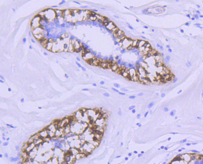 Immunohistochemical analysis of paraffin-embedded human breast tissue using anti-Calponin antibody. The section was pre-treated using heat mediated antigen retrieval with Tris-EDTA buffer (pH 8.0-8.4) for 20 minutes.The tissues were blocked in 5% BSA for 30 minutes at room temperature, washed with ddH2O and PBS, and then probed with the primary antibody (ET1606-17, 1/50) for 30 minutes at room temperature. The detection was performed using an HRP conjugated compact polymer system. DAB was used as the chromogen. Tissues were counterstained with hematoxylin and mounted with DPX.