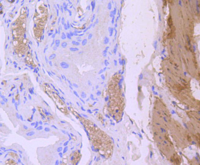 Immunohistochemical analysis of paraffin-embedded human bladder tissue using anti-Calponin antibody. The section was pre-treated using heat mediated antigen retrieval with Tris-EDTA buffer (pH 8.0-8.4) for 20 minutes.The tissues were blocked in 5% BSA for 30 minutes at room temperature, washed with ddH2O and PBS, and then probed with the primary antibody (ET1606-17, 1/50) for 30 minutes at room temperature. The detection was performed using an HRP conjugated compact polymer system. DAB was used as the chromogen. Tissues were counterstained with hematoxylin and mounted with DPX.