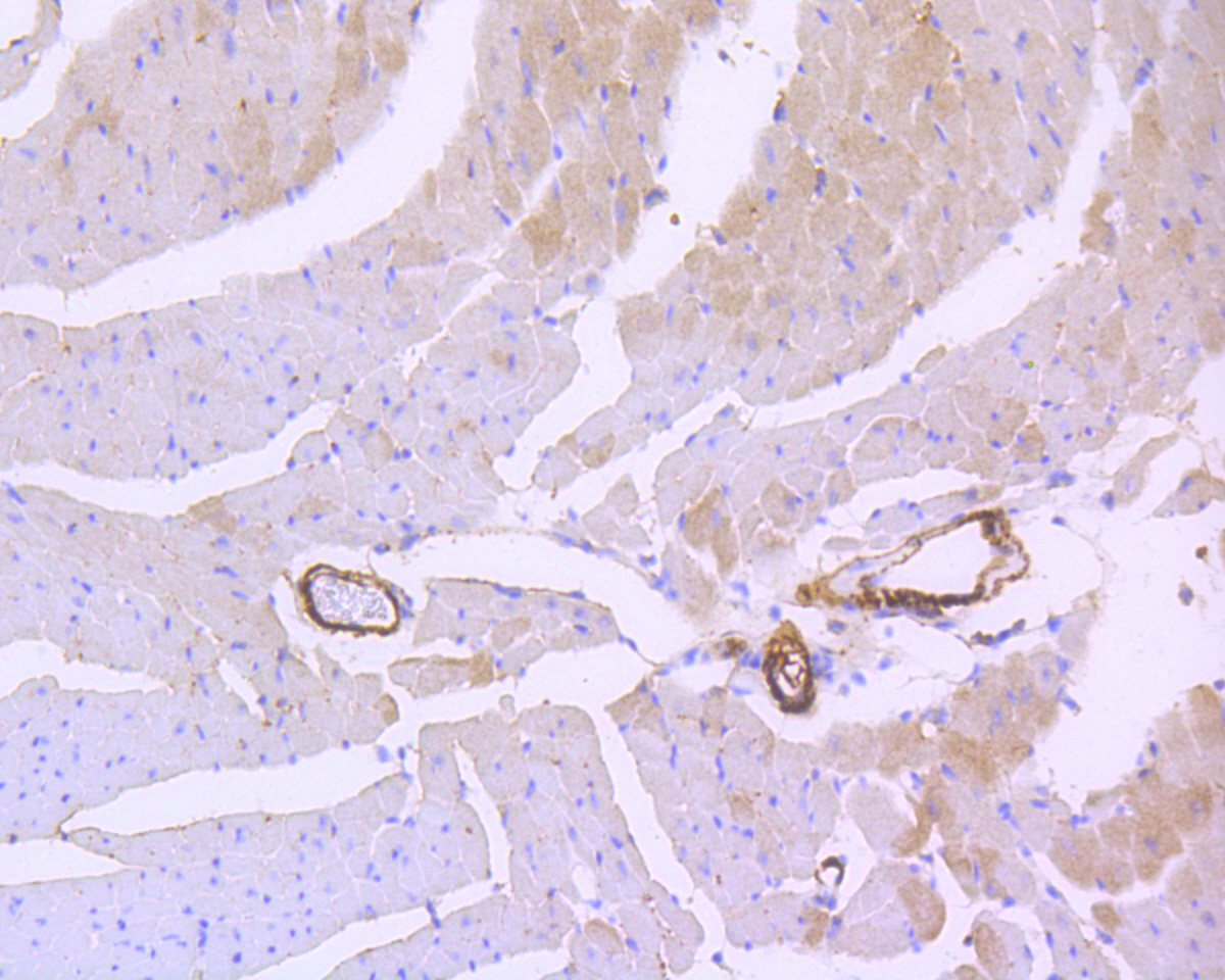 Immunohistochemical analysis of paraffin-embedded mouse heart tissue using anti-Calponin antibody. The section was pre-treated using heat mediated antigen retrieval with Tris-EDTA buffer (pH 8.0-8.4) for 20 minutes.The tissues were blocked in 5% BSA for 30 minutes at room temperature, washed with ddH2O and PBS, and then probed with the primary antibody (ET1606-17, 1/50) for 30 minutes at room temperature. The detection was performed using an HRP conjugated compact polymer system. DAB was used as the chromogen. Tissues were counterstained with hematoxylin and mounted with DPX.