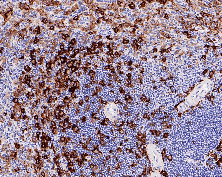 Immunohistochemical analysis of paraffin-embedded human spleen tissue with Rabbit anti-CD11c antibody (ET1606-19) at 1/500 dilution.<br />
<br />
The section was pre-treated using heat mediated antigen retrieval with Tris-EDTA buffer (pH 9.0) for 20 minutes. The tissues were blocked in 1% BSA for 20 minutes at room temperature, washed with ddH2O and PBS, and then probed with the primary antibody (ET1606-19) at 1/500 dilution for 1 hour at room temperature. The detection was performed using an HRP conjugated compact polymer system. DAB was used as the chromogen. Tissues were counterstained with hematoxylin and mounted with DPX.