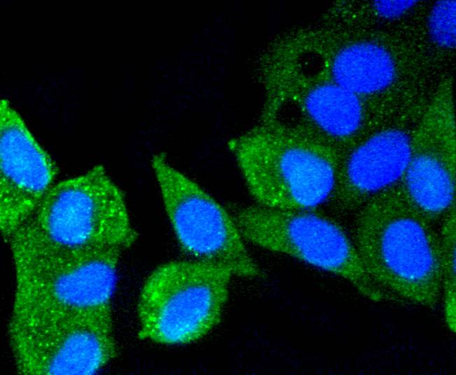ICC staining of ATM in MCF-7 cells (green). Formalin fixed cells were permeabilized with 0.1% Triton X-100 in TBS for 10 minutes at room temperature and blocked with 1% Blocker BSA for 15 minutes at room temperature. Cells were probed with the primary antibody (ET1606-20, 1/50) for 1 hour at room temperature, washed with PBS. Alexa Fluor®488 Goat anti-Rabbit IgG was used as the secondary antibody at 1/1,000 dilution. The nuclear counter stain is DAPI (blue).