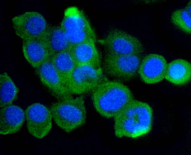 ICC staining of ATM in CRC cells (green). Formalin fixed cells were permeabilized with 0.1% Triton X-100 in TBS for 10 minutes at room temperature and blocked with 1% Blocker BSA for 15 minutes at room temperature. Cells were probed with the primary antibody (ET1606-20, 1/50) for 1 hour at room temperature, washed with PBS. Alexa Fluor®488 Goat anti-Rabbit IgG was used as the secondary antibody at 1/1,000 dilution. The nuclear counter stain is DAPI (blue).