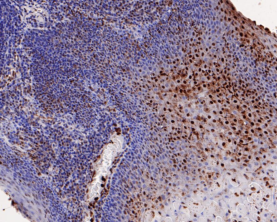 Immunohistochemical analysis of paraffin-embedded human pancreas tissue using anti-ATM antibody. The section was pre-treated using heat mediated antigen retrieval with Tris-EDTA buffer (pH 8.0-8.4) for 20 minutes.The tissues were blocked in 5% BSA for 30 minutes at room temperature, washed with ddH2O and PBS, and then probed with the primary antibody (ET1606-20, 1/50) for 30 minutes at room temperature. The detection was performed using an HRP conjugated compact polymer system. DAB was used as the chromogen. Tissues were counterstained with hematoxylin and mounted with DPX.