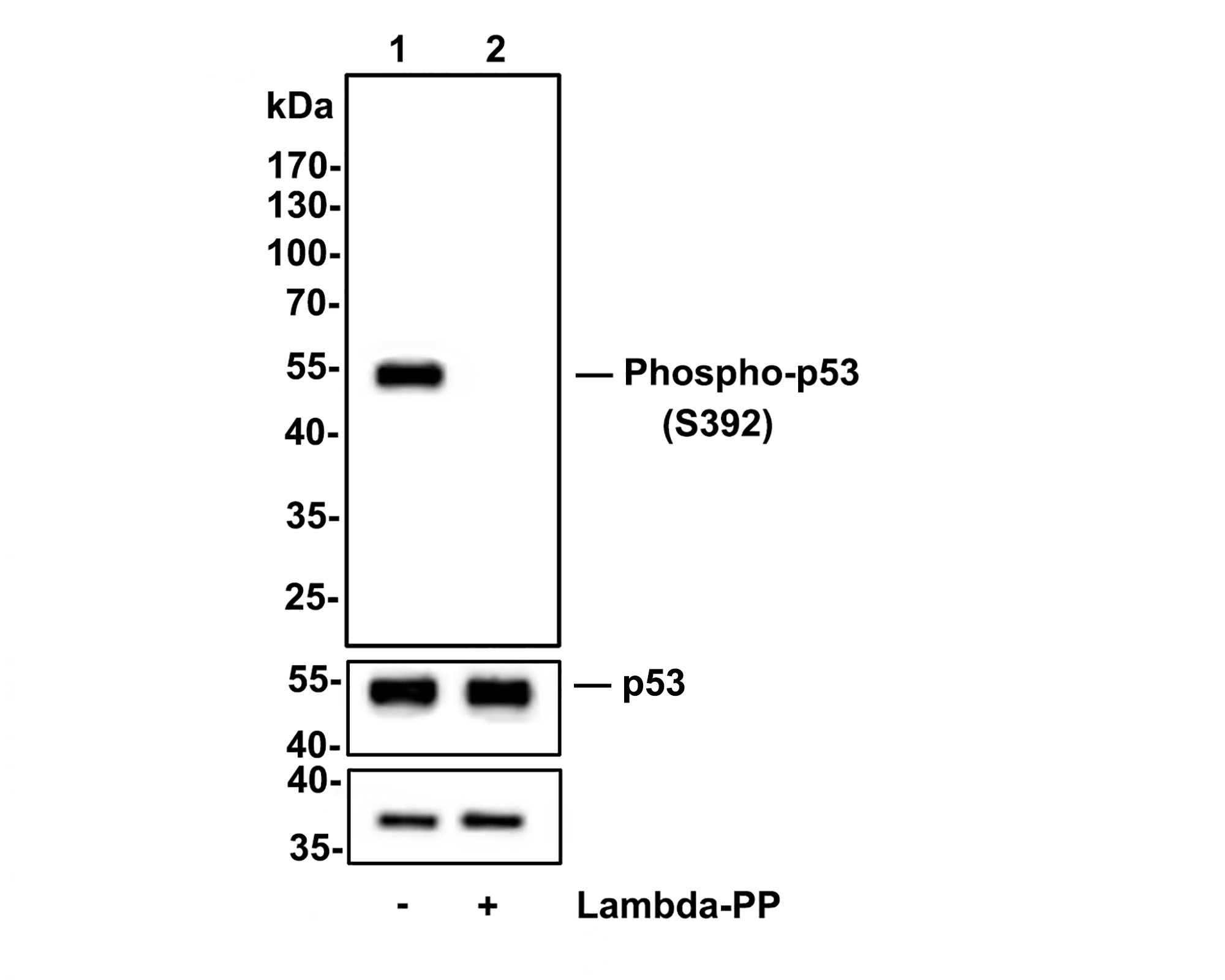 Western blot analysis of Phospho-p53(S392) on 293 cell lysates.<br />
<br />
Lane 1: 293 cells, whole cell lysate, 10ug/lane<br />
Lane 2: 293 cells treated with 2.8ug/ul lambda-PP for 30 minutes, whole cell lysates, 10ug/lane<br />
<br />
All lanes :<br />
Anti-Phospho-p53(S392) antibody (ET1606-24) at 1:500 dilution. Anti-GAPDH antibody (ET1601-4) at 1:10,000 dilution. Goat Anti-Rabbit IgG H&L (HRP) (HA1001) at 1/200,000 dilution.<br />
<br />
Predicted band size: 53 kDa<br />
Observed band size: 53 kDa<br />
<br />
Blocking and diluting buffer: 5% BSA.<br />
<br />
Exposure time: 10 seconds