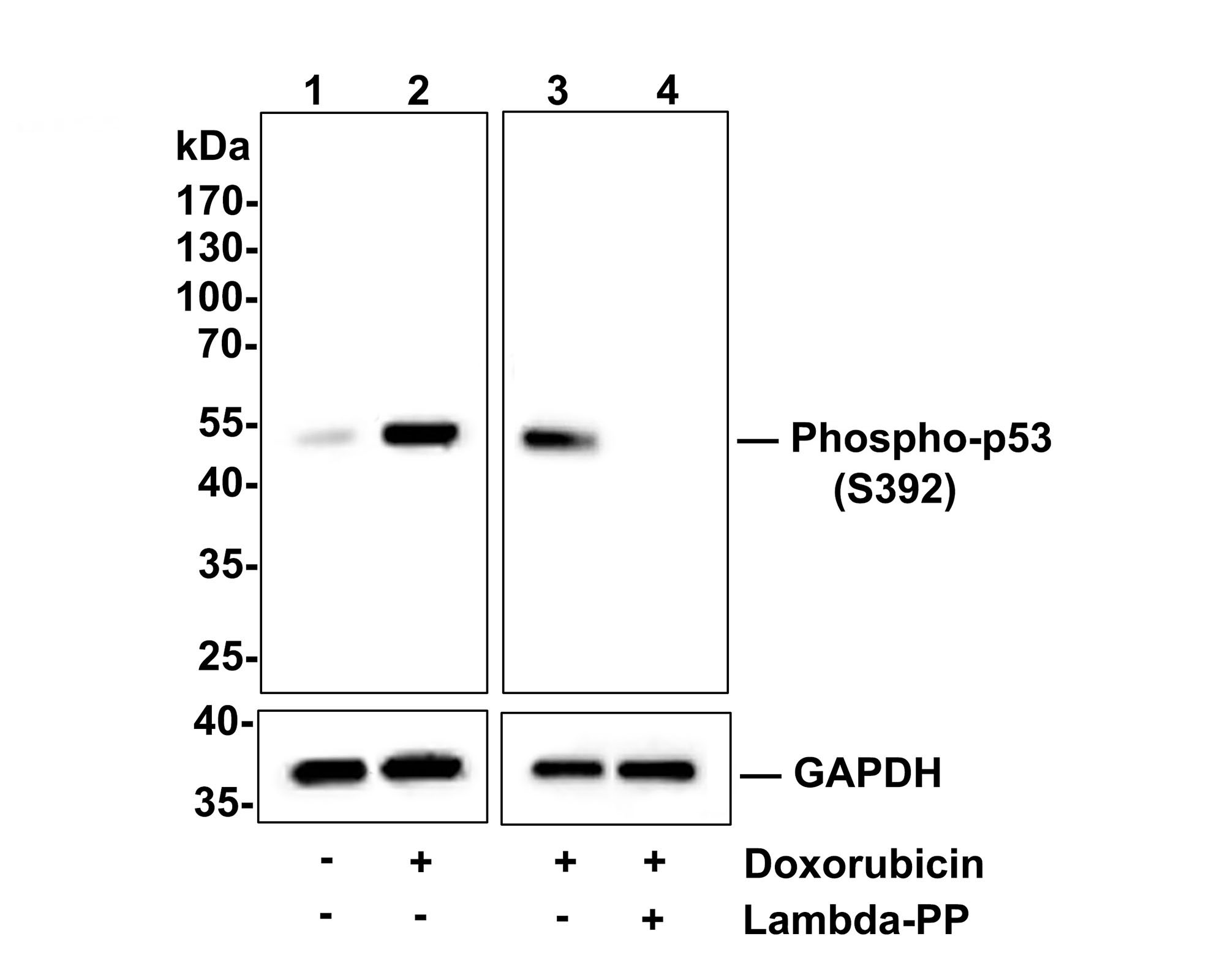 Western blot analysis of Phospho-p53(S392) on A549 cell lysates.<br />
<br />
Lane 1: A549 cells, whole cell lysate, 10ug/lane<br />
Lane 2/3: A549 cells treated with 250nM Doxorubicin overnight, whole cell lysates, 10ug/lane<br />
Lane 4: A549 cells treated with 250nM Doxorubicin overnight, then treated with 2.8ug/ul lambda-PP for 30 minutes, whole cell lysates, 10ug/lane<br />
<br />
All lanes :<br />
Anti-Phospho-p53(S392) antibody (ET1606-24) at 1:500 dilution. Anti-GAPDH antibody (ET1601-4) at 1:10,000 dilution. Goat Anti-Rabbit IgG H&L (HRP) (HA1001) at 1/200,000 dilution.<br />
<br />
Predicted band size: 53 kDa<br />
Observed band size: 53 kDa<br />
<br />
Blocking and diluting buffer: 5% BSA.<br />
<br />
Exposure time: 5 minutes