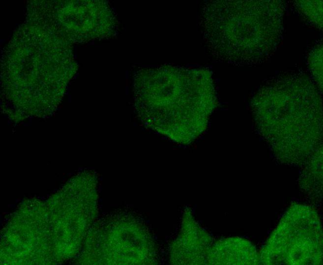 ICC staining of Smad5 in A549 cells (green). Formalin fixed cells were permeabilized with 0.1% Triton X-100 in TBS for 10 minutes at room temperature and blocked with 1% Blocker BSA for 15 minutes at room temperature. Cells were probed with the primary antibody (ET1606-26, 1/50) for 1 hour at room temperature, washed with PBS. Alexa Fluor®488 Goat anti-Rabbit IgG was used as the secondary antibody at 1/1,000 dilution.