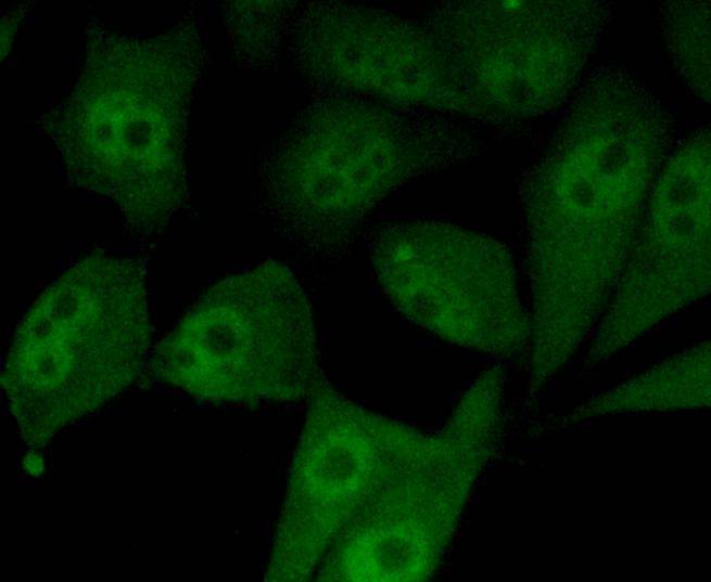 ICC staining of Smad5 in PC-3M cells (green). Formalin fixed cells were permeabilized with 0.1% Triton X-100 in TBS for 10 minutes at room temperature and blocked with 1% Blocker BSA for 15 minutes at room temperature. Cells were probed with the primary antibody (ET1606-26, 1/50) for 1 hour at room temperature, washed with PBS. Alexa Fluor®488 Goat anti-Rabbit IgG was used as the secondary antibody at 1/1,000 dilution.