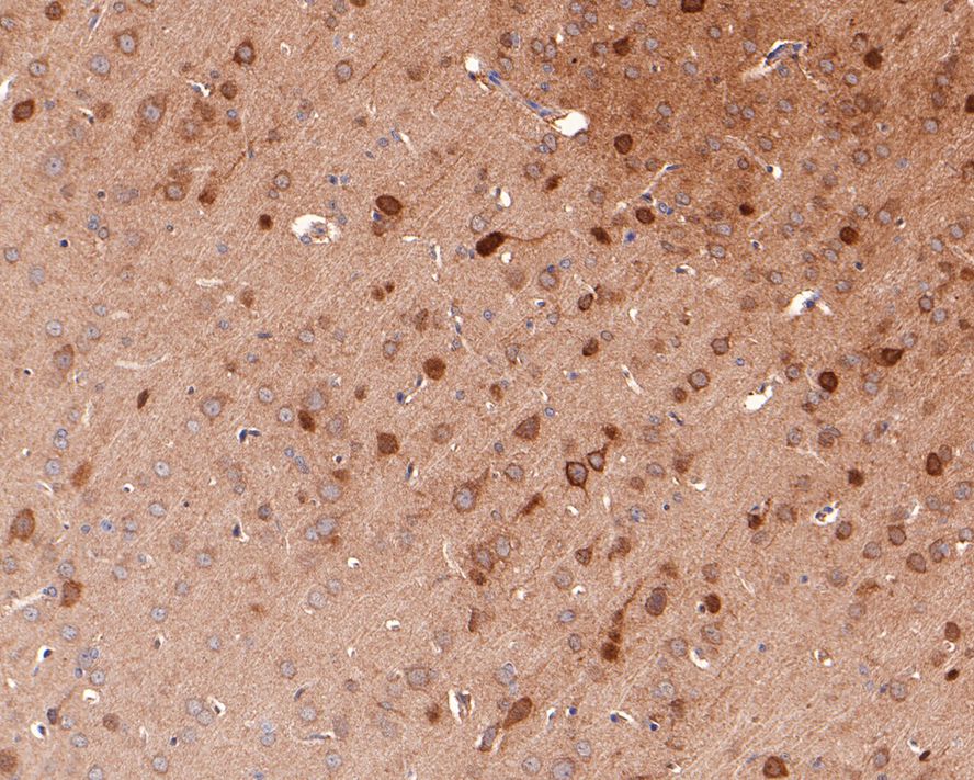 Immunohistochemical analysis of paraffin-embedded rat brain tissue with Rabbit anti-NGF antibody (ET1606-29) at 1/100 dilution.<br />
<br />
The section was pre-treated using heat mediated antigen retrieval with Tris-EDTA buffer (pH 9.0) for 20 minutes. The tissues were blocked in 1% BSA for 20 minutes at room temperature, washed with ddH2O and PBS, and then probed with the primary antibody (ET1606-29) at 1/100 dilution for 1 hour at room temperature. The detection was performed using an HRP conjugated compact polymer system. DAB was used as the chromogen. Tissues were counterstained with hematoxylin and mounted with DPX.