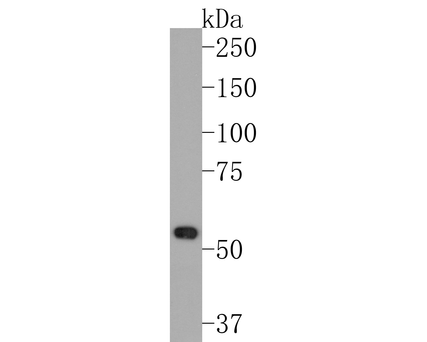 Western blot analysis of Desmin on rat skeletal muscle tissue lysates. Proteins were transferred to a PVDF membrane and blocked with 5% BSA in PBS for 1 hour at room temperature. The primary antibody (ET1606-30, 1/500) was used in 5% BSA at room temperature for 2 hours. Goat Anti-Rabbit IgG - HRP Secondary Antibody (HA1001) at 1:200,000 dilution was used for 1 hour at room temperature.