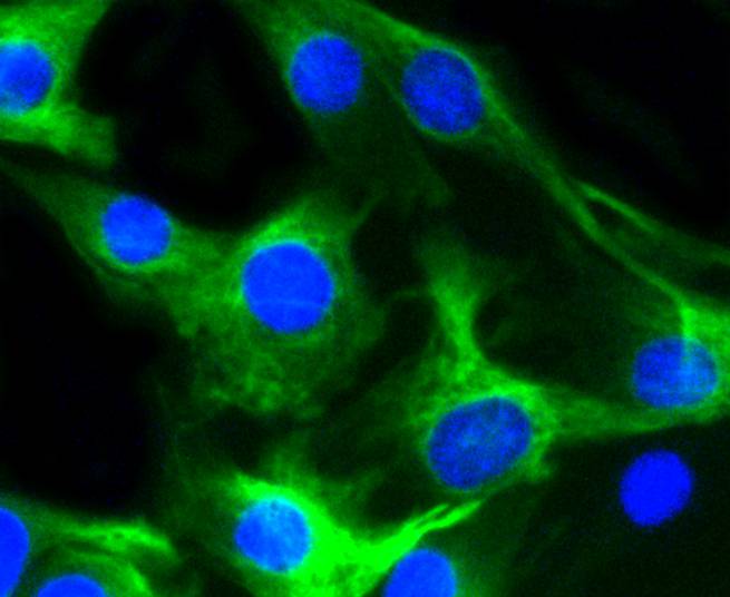 ICC staining of Desmin in C2C12 cells (green). Formalin fixed cells were permeabilized with 0.1% Triton X-100 in TBS for 10 minutes at room temperature and blocked with 10% negative goat serum for 15 minutes at room temperature. Cells were probed with the primary antibody (ET1606-30, 1/200) for 1 hour at room temperature, washed with PBS. Alexa Fluor®488 conjugate-Goat anti-Rabbit IgG was used as the secondary antibody at 1/1,000 dilution. The nuclear counter stain is DAPI (blue).