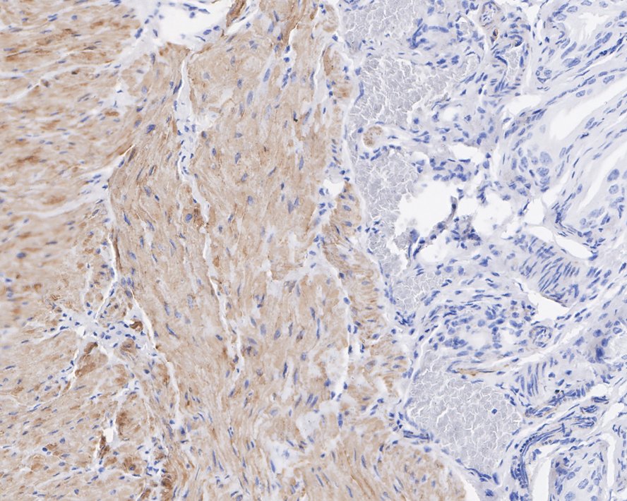 Immunohistochemical analysis of paraffin-embedded mouse bladder tissue using anti-Desmin antibody. The section was pre-treated using heat mediated antigen retrieval with Tris-EDTA buffer (pH 9.0) for 20 minutes.The tissues were blocked in 1% BSA for 30 minutes at room temperature, washed with ddH2O and PBS, and then probed with the primary antibody (ET1606-30, 1/50) for 30 minutes at room temperature. The detection was performed using an HRP conjugated compact polymer system. DAB was used as the chromogen. Tissues were counterstained with hematoxylin and mounted with DPX.