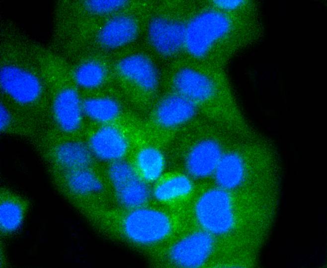 ICC staining of CD8 alpha in Hela cells (green). Formalin fixed cells were permeabilized with 0.1% Triton X-100 in TBS for 10 minutes at room temperature and blocked with 1% Blocker BSA for 15 minutes at room temperature. Cells were probed with the primary antibody (ET1606-31, 1/50) for 1 hour at room temperature, washed with PBS. Alexa Fluor®488 Goat anti-Rabbit IgG was used as the secondary antibody at 1/1,000 dilution. The nuclear counter stain is DAPI (blue).