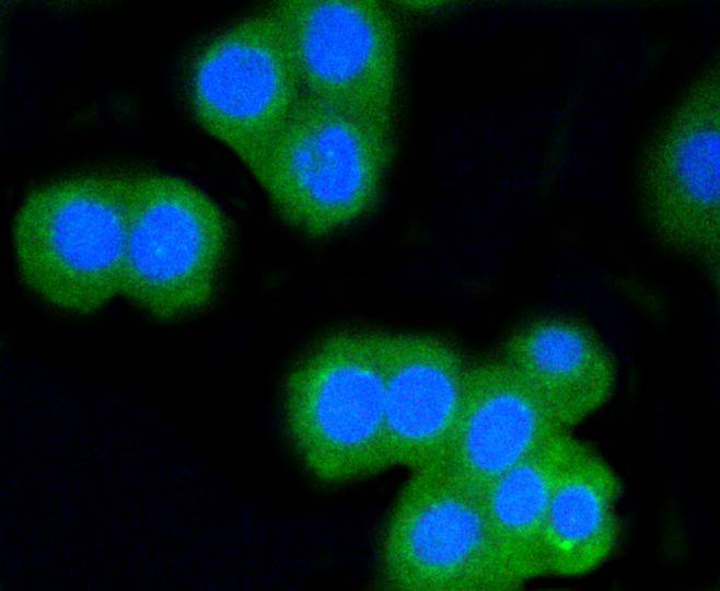 ICC staining of CD8 alpha in CRC cells (green). Formalin fixed cells were permeabilized with 0.1% Triton X-100 in TBS for 10 minutes at room temperature and blocked with 1% Blocker BSA for 15 minutes at room temperature. Cells were probed with the primary antibody (ET1606-31, 1/50) for 1 hour at room temperature, washed with PBS. Alexa Fluor®488 Goat anti-Rabbit IgG was used as the secondary antibody at 1/1,000 dilution. The nuclear counter stain is DAPI (blue).