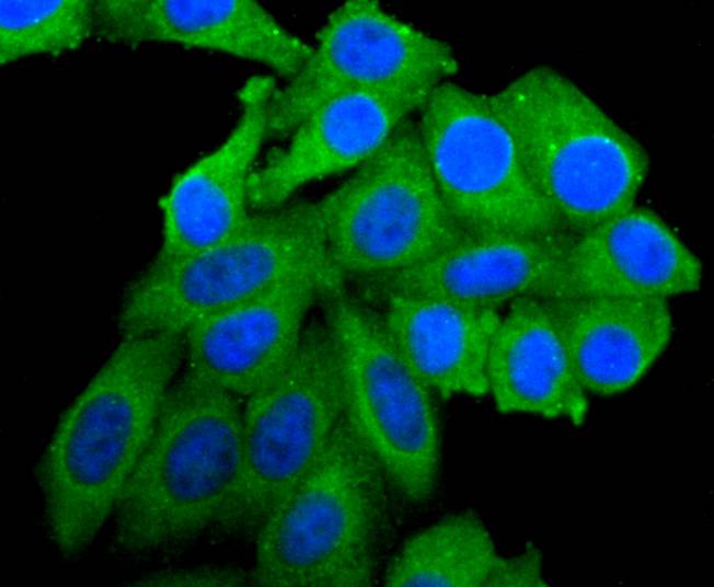 ICC staining of PI 3 Kinase catalytic subunit alpha in Hela cells (green). Formalin fixed cells were permeabilized with 0.1% Triton X-100 in TBS for 10 minutes at room temperature and blocked with 1% Blocker BSA for 15 minutes at room temperature. Cells were probed with the primary antibody (ET1606-36, 1/50) for 1 hour at room temperature, washed with PBS. Alexa Fluor®488 Goat anti-Rabbit IgG was used as the secondary antibody at 1/1,000 dilution. The nuclear counter stain is DAPI (blue).