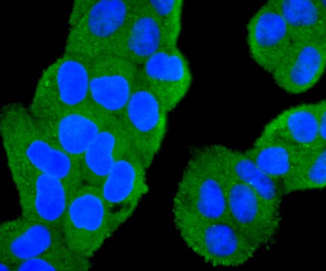 ICC staining of PI 3 Kinase catalytic subunit alpha in MCF-7 cells (green). Formalin fixed cells were permeabilized with 0.1% Triton X-100 in TBS for 10 minutes at room temperature and blocked with 1% Blocker BSA for 15 minutes at room temperature. Cells were probed with the primary antibody (ET1606-36, 1/50) for 1 hour at room temperature, washed with PBS. Alexa Fluor®488 Goat anti-Rabbit IgG was used as the secondary antibody at 1/1,000 dilution. The nuclear counter stain is DAPI (blue).