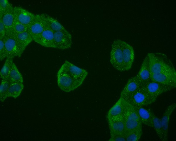ICC staining of BDNF in Hela cells (green). Formalin fixed cells were permeabilized with 0.1% Triton X-100 in TBS for 10 minutes at room temperature and blocked with 1% Blocker BSA for 15 minutes at room temperature. Cells were probed with the primary antibody (ET1606-42, 1/200) for 1 hour at room temperature, washed with PBS. Alexa Fluor®488 Goat anti-Rabbit IgG was used as the secondary antibody at 1/1,000 dilution. The nuclear counter stain is DAPI (blue).