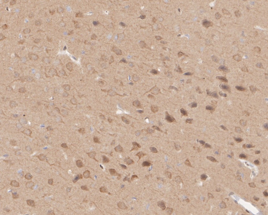 ICC staining of PTEN in A549 cells (green). Formalin fixed cells were permeabilized with 0.1% Triton X-100 in TBS for 10 minutes at room temperature and blocked with 1% Blocker BSA for 15 minutes at room temperature. Cells were probed with the primary antibody (ET1606-43, 1/100) for 1 hour at room temperature, washed with PBS. Alexa Fluor®488 Goat anti-Rabbit IgG was used as the secondary antibody at 1/1,000 dilution. The nuclear counter stain is DAPI (blue).