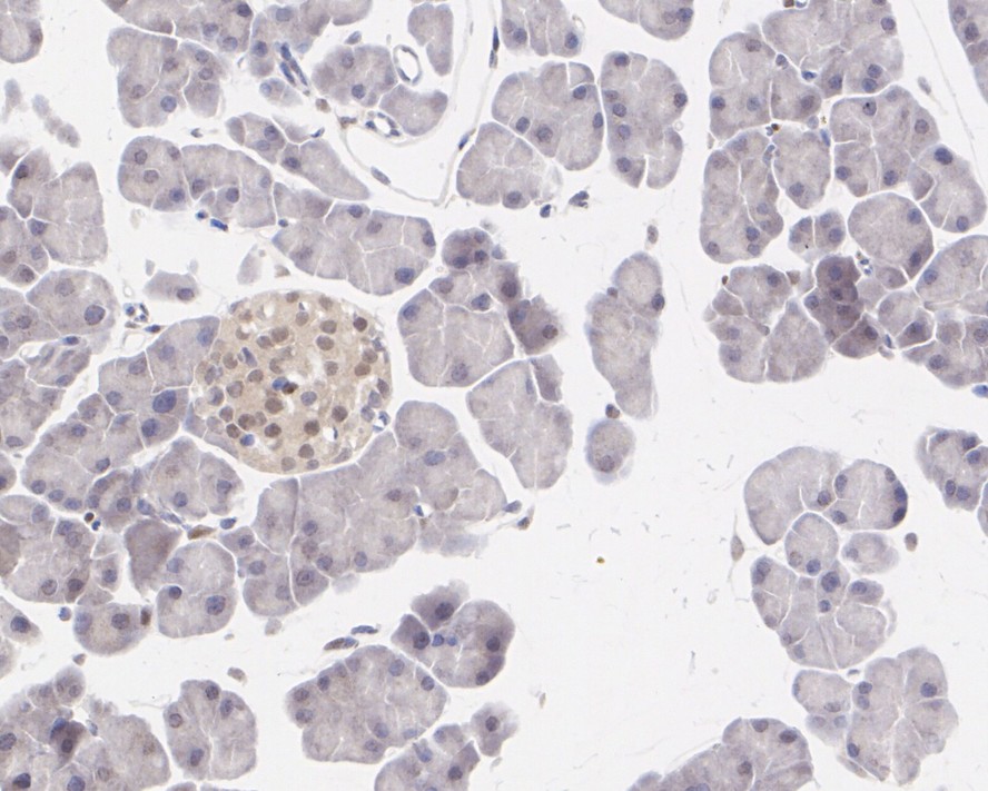 ICC staining of PTEN in SW480 cells (green). Formalin fixed cells were permeabilized with 0.1% Triton X-100 in TBS for 10 minutes at room temperature and blocked with 1% Blocker BSA for 15 minutes at room temperature. Cells were probed with the primary antibody (ET1606-43, 1/100) for 1 hour at room temperature, washed with PBS. Alexa Fluor®488 Goat anti-Rabbit IgG was used as the secondary antibody at 1/1,000 dilution. The nuclear counter stain is DAPI (blue).
