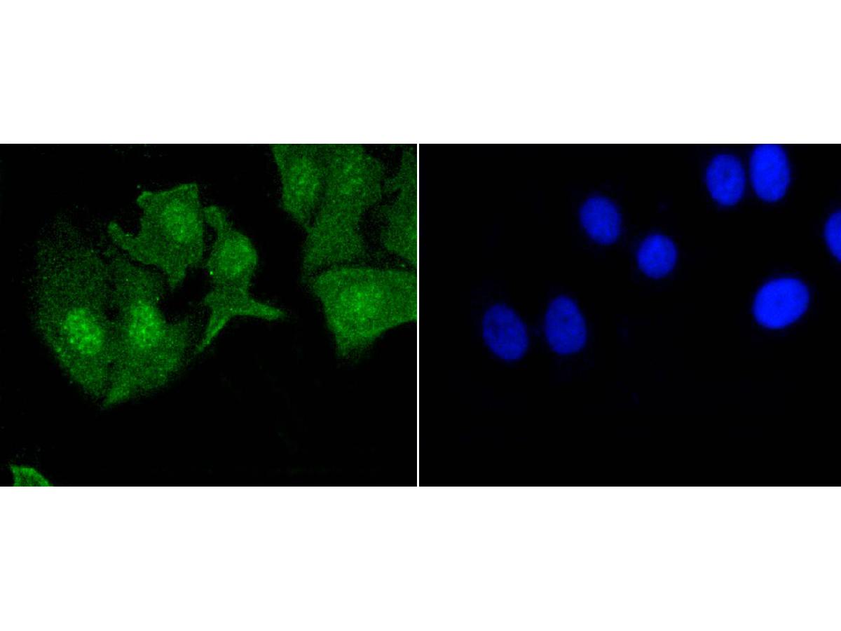 ICC staining of Phospho-EGFR (Y1092) in BT-20 cells (green). Formalin fixed cells were permeabilized with 0.1% Triton X-100 in TBS for 10 minutes at room temperature and blocked with 1% Blocker BSA for 15 minutes at room temperature. Cells were probed with the primary antibody (ET1606-44, 1/50) for 1 hour at room temperature, washed with PBS. Alexa Fluor®488 Goat anti-Rabbit IgG was used as the secondary antibody at 1/1,000 dilution. The nuclear counter stain is DAPI (blue).