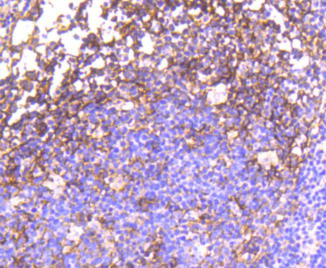 Immunohistochemical analysis of paraffin-embedded human tonsil tissue using anti-Phospho-EGFR (Y1092) antibody. The section was pre-treated using heat mediated antigen retrieval with Tris-EDTA buffer (pH 8.0-8.4) for 20 minutes.The tissues were blocked in 5% BSA for 30 minutes at room temperature, washed with ddH2O and PBS, and then probed with the primary antibody (ET1606-44, 1/50) for 30 minutes at room temperature. The detection was performed using an HRP conjugated compact polymer system. DAB was used as the chromogen. Tissues were counterstained with hematoxylin and mounted with DPX.