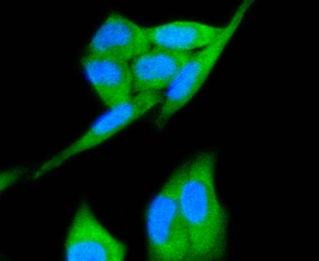 ICC staining of Met (C-Met) in Hela cells (green). Formalin fixed cells were permeabilized with 0.1% Triton X-100 in TBS for 10 minutes at room temperature and blocked with 1% Blocker BSA for 15 minutes at room temperature. Cells were probed with the primary antibody (ET1606-45, 1/50) for 1 hour at room temperature, washed with PBS. Alexa Fluor®488 Goat anti-Rabbit IgG was used as the secondary antibody at 1/1,000 dilution. The nuclear counter stain is DAPI (blue).