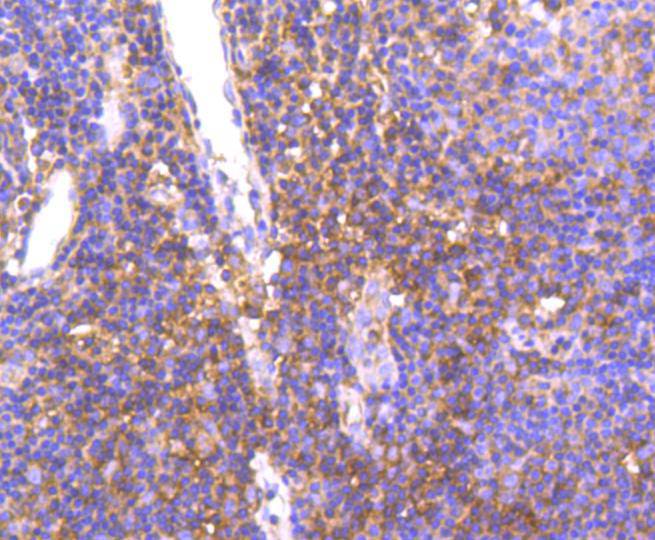 Immunohistochemical analysis of paraffin-embedded human tonsil tissue using anti-Met(C-Met) antibody. The section was pre-treated using heat mediated antigen retrieval with Tris-EDTA buffer (pH 8.0-8.4) for 20 minutes.The tissues were blocked in 5% BSA for 30 minutes at room temperature, washed with ddH2O and PBS, and then probed with the primary antibody (ET1606-45, 1/50) for 30 minutes at room temperature. The detection was performed using an HRP conjugated compact polymer system. DAB was used as the chromogen. Tissues were counterstained with hematoxylin and mounted with DPX.