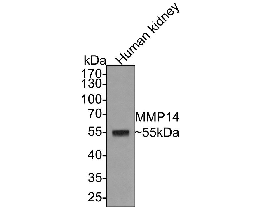 Western blot analysis of MMP14 on human kidney tissue lysates with Rabbit anti-MMP14 antibody (ET1606-48) at 1/1,000 dilution.<br />
<br />
Lysates/proteins at 20 µg/Lane.<br />
<br />
Predicted band size: 66 kDa<br />
Observed band size: 55 kDa<br />
<br />
Exposure time: 2 minutes;<br />
<br />
10% SDS-PAGE gel.<br />
<br />
Proteins were transferred to a PVDF membrane and blocked with 5% NFDM/TBST for 1 hour at room temperature. The primary antibody (ET1606-48) at 1/1,000 dilution was used in 5% NFDM/TBST at room temperature for 2 hours. Goat Anti-Rabbit IgG - HRP Secondary Antibody (HA1001) at 1:300,000 dilution was used for 1 hour at room temperature.