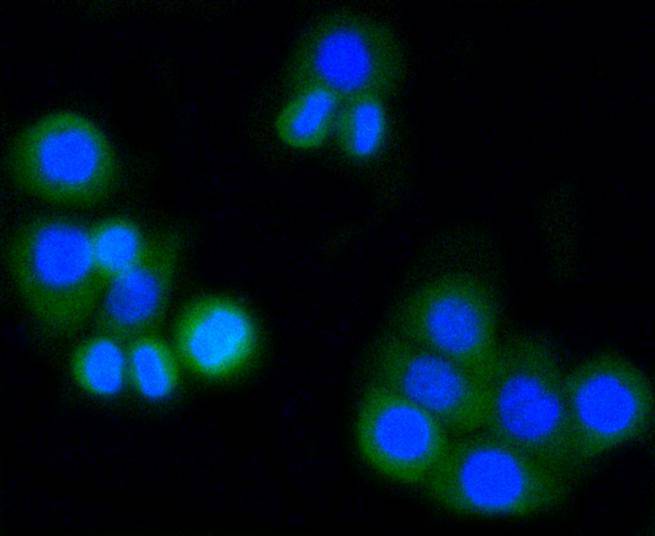 ICC staining of MMP14 in BT-20 cells (green). Formalin fixed cells were permeabilized with 0.1% Triton X-100 in TBS for 10 minutes at room temperature and blocked with 1% Blocker BSA for 15 minutes at room temperature. Cells were probed with the primary antibody (ET1606-48, 1/50) for 1 hour at room temperature, washed with PBS. Alexa Fluor®488 Goat anti-Rabbit IgG was used as the secondary antibody at 1/1,000 dilution. The nuclear counter stain is DAPI (blue).