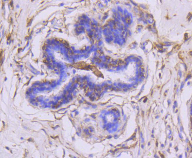 Immunohistochemical analysis of paraffin-embedded human kidney tissue using anti-MMP14 antibody. The section was pre-treated using heat mediated antigen retrieval with Tris-EDTA buffer (pH 8.0-8.4) for 20 minutes.The tissues were blocked in 5% BSA for 30 minutes at room temperature, washed with ddH2O and PBS, and then probed with the primary antibody (ET1606-48, 1/50) for 30 minutes at room temperature. The detection was performed using an HRP conjugated compact polymer system. DAB was used as the chromogen. Tissues were counterstained with hematoxylin and mounted with DPX.