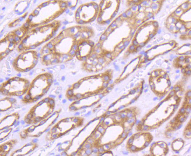Immunohistochemical analysis of paraffin-embedded human uterus tissue using anti-MMP14 antibody. The section was pre-treated using heat mediated antigen retrieval with Tris-EDTA buffer (pH 8.0-8.4) for 20 minutes.The tissues were blocked in 5% BSA for 30 minutes at room temperature, washed with ddH2O and PBS, and then probed with the primary antibody (ET1606-48, 1/50) for 30 minutes at room temperature. The detection was performed using an HRP conjugated compact polymer system. DAB was used as the chromogen. Tissues were counterstained with hematoxylin and mounted with DPX.