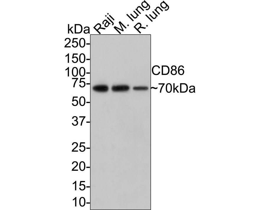 ICC staining of CD86 in Hela cells (green). Formalin fixed cells were permeabilized with 0.1% Triton X-100 in TBS for 10 minutes at room temperature and blocked with 1% Blocker BSA for 15 minutes at room temperature. Cells were probed with the primary antibody (ET1606-50, 1/50) for 1 hour at room temperature, washed with PBS. Alexa Fluor®488 Goat anti-Rabbit IgG was used as the secondary antibody at 1/1,000 dilution. The nuclear counter stain is DAPI (blue).