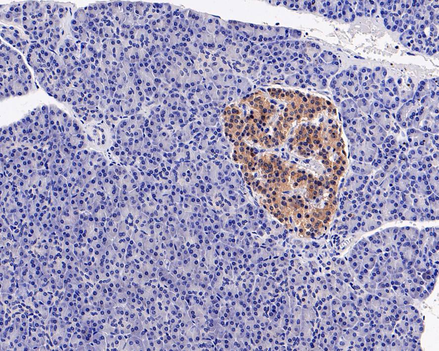 Immunohistochemical analysis of paraffin-embedded human pancreas tissue with Rabbit anti-Musashi 1 antibody (ET1606-51) at 1/200 dilution.<br />
<br />
The section was pre-treated using heat mediated antigen retrieval with Tris-EDTA buffer (pH 9.0) for 20 minutes. The tissues were blocked in 1% BSA for 20 minutes at room temperature, washed with ddH2O and PBS, and then probed with the primary antibody (ET1606-51) at 1/200 dilution for 1 hour at room temperature. The detection was performed using an HRP conjugated compact polymer system. DAB was used as the chromogen. Tissues were counterstained with hematoxylin and mounted with DPX.