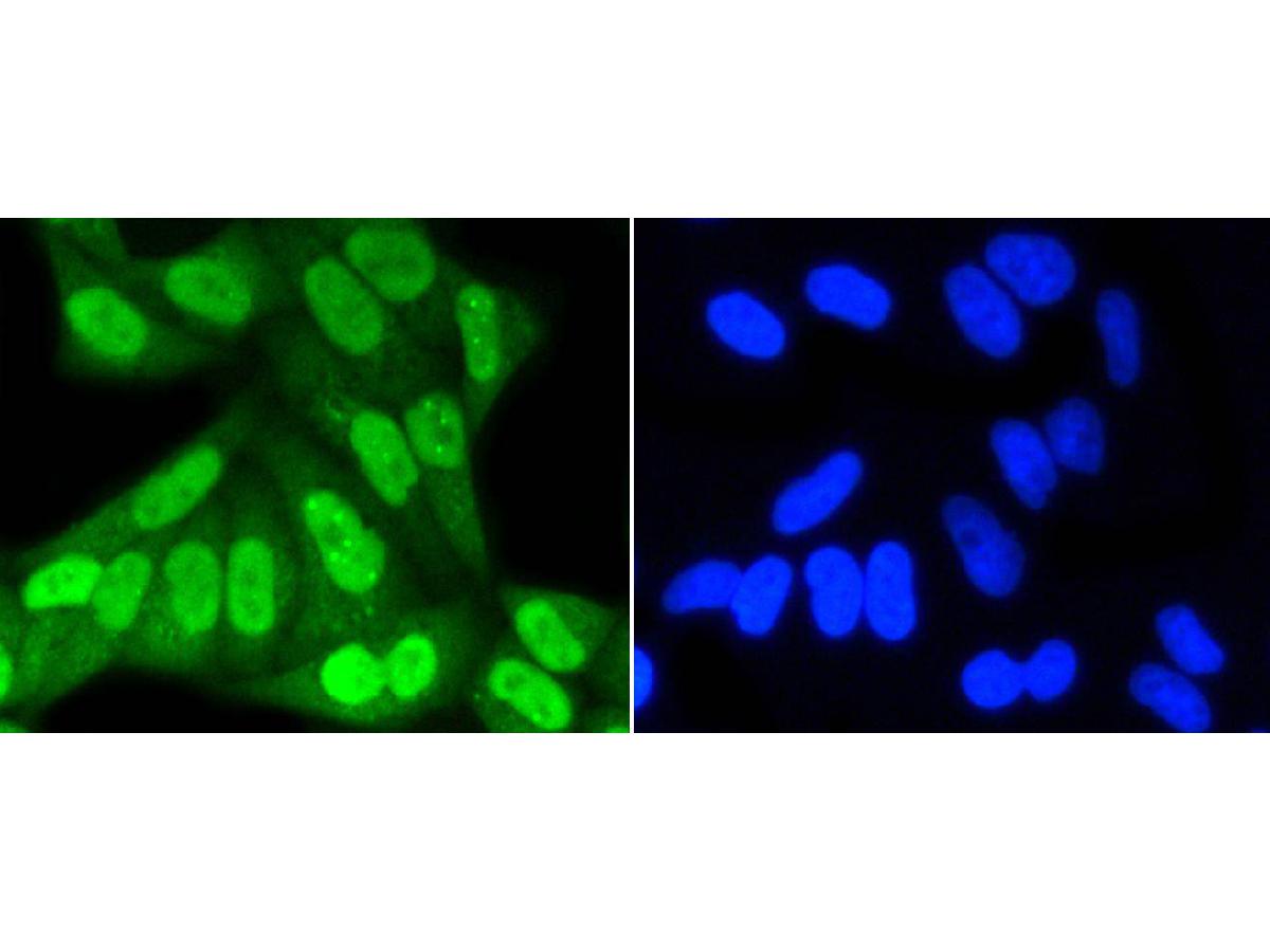 ICC staining of SUMO-1 in Hela cells (green). Formalin fixed cells were permeabilized with 0.1% Triton X-100 in TBS for 10 minutes at room temperature and blocked with 1% Blocker BSA for 15 minutes at room temperature. Cells were probed with the primary antibody (ET1606-53, 1/50) for 1 hour at room temperature, washed with PBS. Alexa Fluor®488 Goat anti-Rabbit IgG was used as the secondary antibody at 1/1,000 dilution. The nuclear counter stain is DAPI (blue).