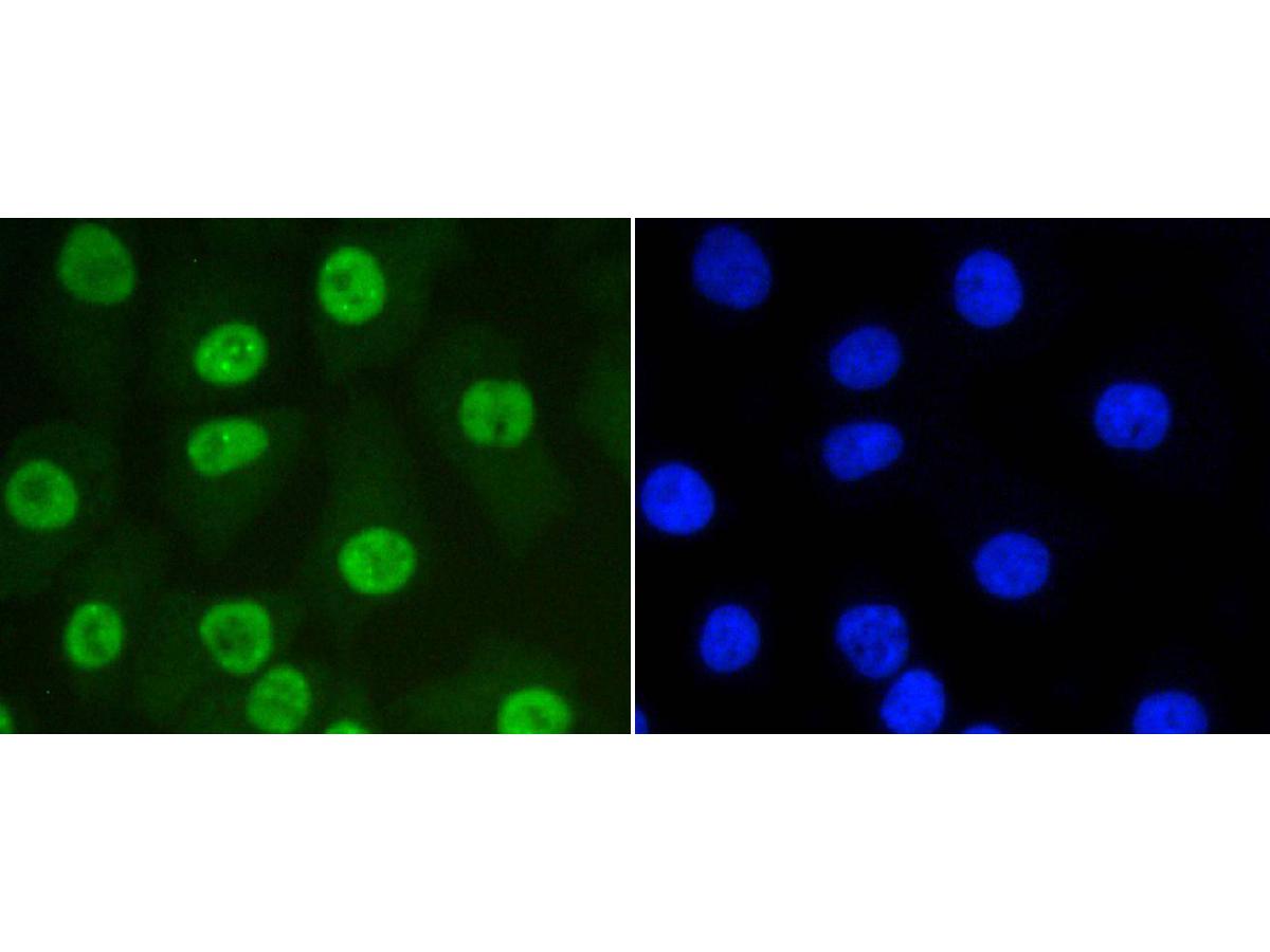 ICC staining of SUMO-1 in A549 cells (green). Formalin fixed cells were permeabilized with 0.1% Triton X-100 in TBS for 10 minutes at room temperature and blocked with 1% Blocker BSA for 15 minutes at room temperature. Cells were probed with the primary antibody (ET1606-53, 1/50) for 1 hour at room temperature, washed with PBS. Alexa Fluor®488 Goat anti-Rabbit IgG was used as the secondary antibody at 1/1,000 dilution. The nuclear counter stain is DAPI (blue).