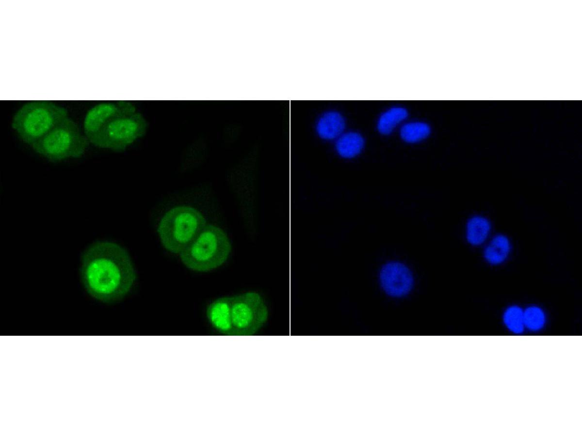 ICC staining of SUMO-1 in MCF-7 cells (green). Formalin fixed cells were permeabilized with 0.1% Triton X-100 in TBS for 10 minutes at room temperature and blocked with 1% Blocker BSA for 15 minutes at room temperature. Cells were probed with the primary antibody (ET1606-53, 1/50) for 1 hour at room temperature, washed with PBS. Alexa Fluor®488 Goat anti-Rabbit IgG was used as the secondary antibody at 1/1,000 dilution. The nuclear counter stain is DAPI (blue).