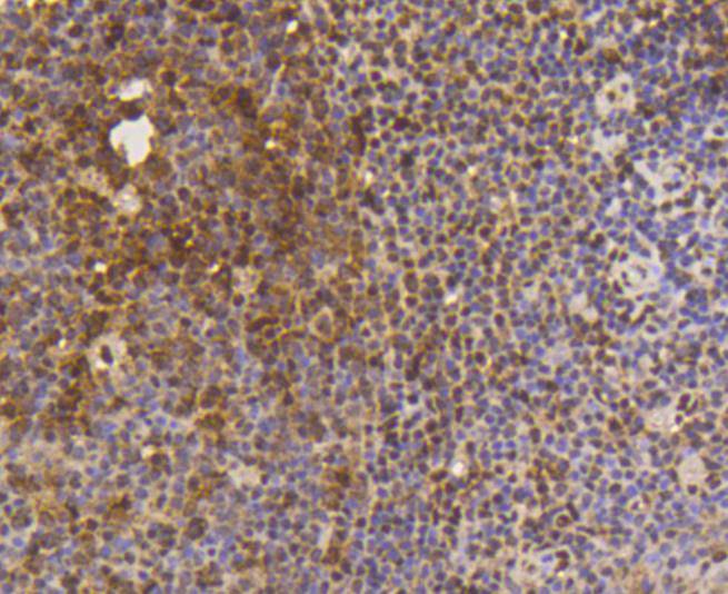 Immunohistochemical analysis of paraffin-embedded human tonsil tissue using anti-SUMO-1 antibody. The section was pre-treated using heat mediated antigen retrieval with Tris-EDTA buffer (pH 8.0-8.4) for 20 minutes.The tissues were blocked in 5% BSA for 30 minutes at room temperature, washed with ddH2O and PBS, and then probed with the primary antibody (ET1606-53, 1/50) for 30 minutes at room temperature. The detection was performed using an HRP conjugated compact polymer system. DAB was used as the chromogen. Tissues were counterstained with hematoxylin and mounted with DPX.