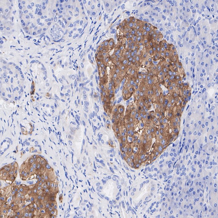 Immunohistochemical analysis of paraffin-embedded human pancreas tissue using anti-Synaptophysin antibody. Counter stained with hematoxylin.