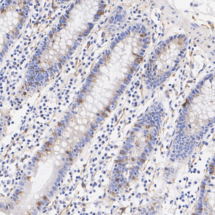 Immunohistochemical analysis of paraffin-embedded mouse brain tissue using anti-Synaptophysin antibody. Counter stained with hematoxylin.