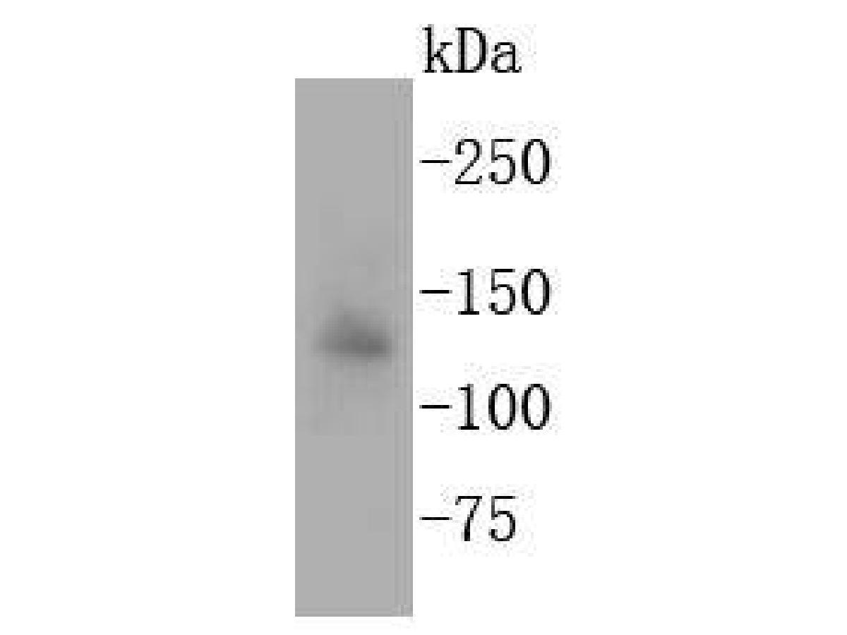 Western blot analysis of Apaf-1 on SW480 cell lysates. Proteins were transferred to a PVDF membrane and blocked with 5% BSA in PBS for 1 hour at room temperature. The primary antibody (ET1607-12, 1/500) was used in 5% BSA at room temperature for 2 hours. Goat Anti-Rabbit IgG - HRP Secondary Antibody (HA1001) at 1:5,000 dilution was used for 1 hour at room temperature.