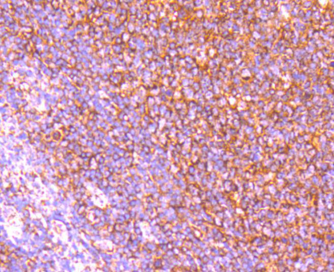 Immunohistochemical analysis of paraffin-embedded mouse colon tissue using anti-Apaf-1 antibody. The section was pre-treated using heat mediated antigen retrieval with Tris-EDTA buffer (pH 8.0-8.4) for 20 minutes.The tissues were blocked in 5% BSA for 30 minutes at room temperature, washed with ddH2O and PBS, and then probed with the primary antibody (ET1607-12, 1/50) for 30 minutes at room temperature. The detection was performed using an HRP conjugated compact polymer system. DAB was used as the chromogen. Tissues were counterstained with hematoxylin and mounted with DPX.