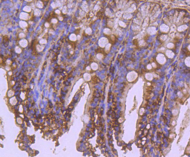 Immunohistochemical analysis of paraffin-embedded mouse skin tissue using anti-Apaf-1 antibody. The section was pre-treated using heat mediated antigen retrieval with Tris-EDTA buffer (pH 8.0-8.4) for 20 minutes.The tissues were blocked in 5% BSA for 30 minutes at room temperature, washed with ddH2O and PBS, and then probed with the primary antibody (ET1607-12, 1/50) for 30 minutes at room temperature. The detection was performed using an HRP conjugated compact polymer system. DAB was used as the chromogen. Tissues were counterstained with hematoxylin and mounted with DPX.