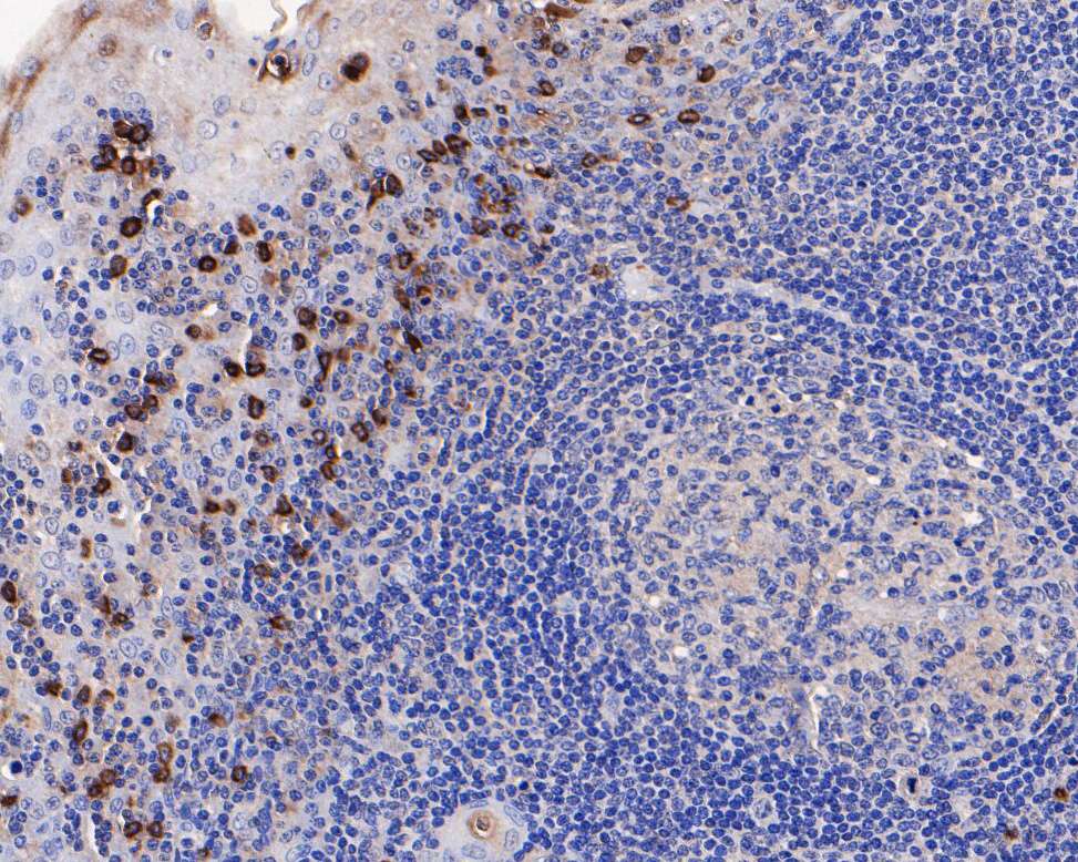 Immunohistochemical analysis of paraffin-embedded human tonsil tissue using anti-CD63 antibody. The section was pre-treated using heat mediated antigen retrieval with Tris-EDTA buffer (pH 8.0-8.4) for 20 minutes.The tissues were blocked in 5% BSA for 30 minutes at room temperature, washed with ddH2O and PBS, and then probed with the primary antibody (ET1607-2, 1/200) for 30 minutes at room temperature. The detection was performed using an HRP conjugated compact polymer system. DAB was used as the chromogen. Tissues were counterstained with hematoxylin and mounted with DPX.