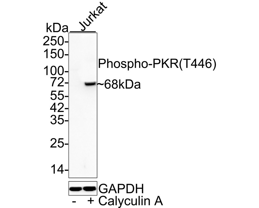 Western blot analysis of Phospho-PKR(T446) on different lysates using anti-Phospho-PKR(T446) antibody at 1/500 dilution.<br />
Lane 1: Hela treated with Calyculin A and TNF-alpha whole cell lysates <br />
Lane 2: Untreated Hela whole cell lysates