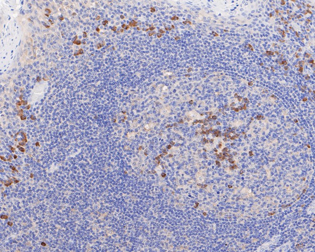 Immunohistochemical analysis of paraffin-embedded human spleen tissue using anti-Phospho-PKR(T446) antibody. The section was pre-treated using heat mediated antigen retrieval with sodium citrate buffer (pH 6.0) for 20 minutes. The tissues were blocked in 5% BSA for 30 minutes at room temperature, washed with ddH2O and PBS, and then probed with the primary antibody (ET1607-20, 1/50)  for 30 minutes at room temperature. The detection was performed using an HRP conjugated compact polymer system. DAB was used as the chromogen. Tissues were counterstained with hematoxylin and mounted with DPX.