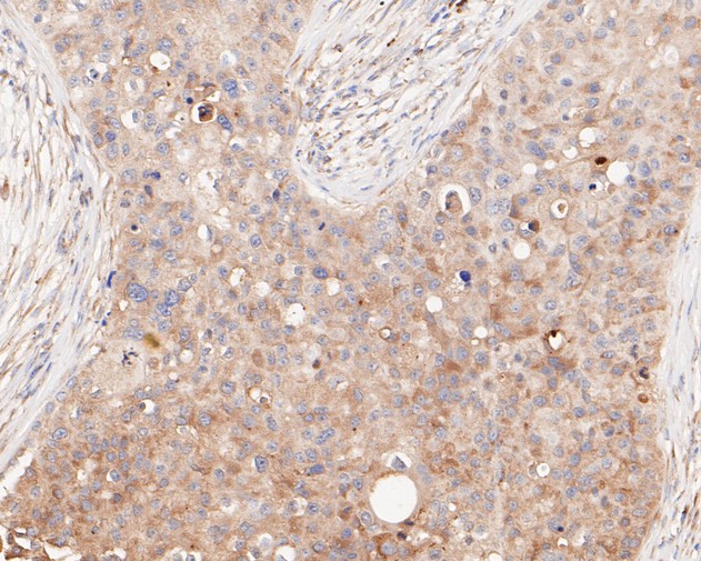 Immunohistochemical analysis of paraffin-embedded human kidney tissue using anti-Phospho-PKR(T446) antibody. The section was pre-treated using heat mediated antigen retrieval with sodium citrate buffer (pH 6.0) for 20 minutes. The tissues were blocked in 5% BSA for 30 minutes at room temperature, washed with ddH2O and PBS, and then probed with the primary antibody (ET1607-20, 1/50)  for 30 minutes at room temperature. The detection was performed using an HRP conjugated compact polymer system. DAB was used as the chromogen. Tissues were counterstained with hematoxylin and mounted with DPX.