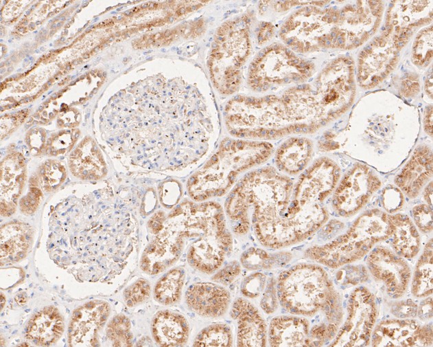 Immunohistochemical analysis of paraffin-embedded human small intestine tissue using anti-Phospho-PKR(T446) antibody. The section was pre-treated using heat mediated antigen retrieval with sodium citrate buffer (pH 6.0) for 20 minutes. The tissues were blocked in 5% BSA for 30 minutes at room temperature, washed with ddH2O and PBS, and then probed with the primary antibody (ET1607-20, 1/50)  for 30 minutes at room temperature. The detection was performed using an HRP conjugated compact polymer system. DAB was used as the chromogen. Tissues were counterstained with hematoxylin and mounted with DPX.
