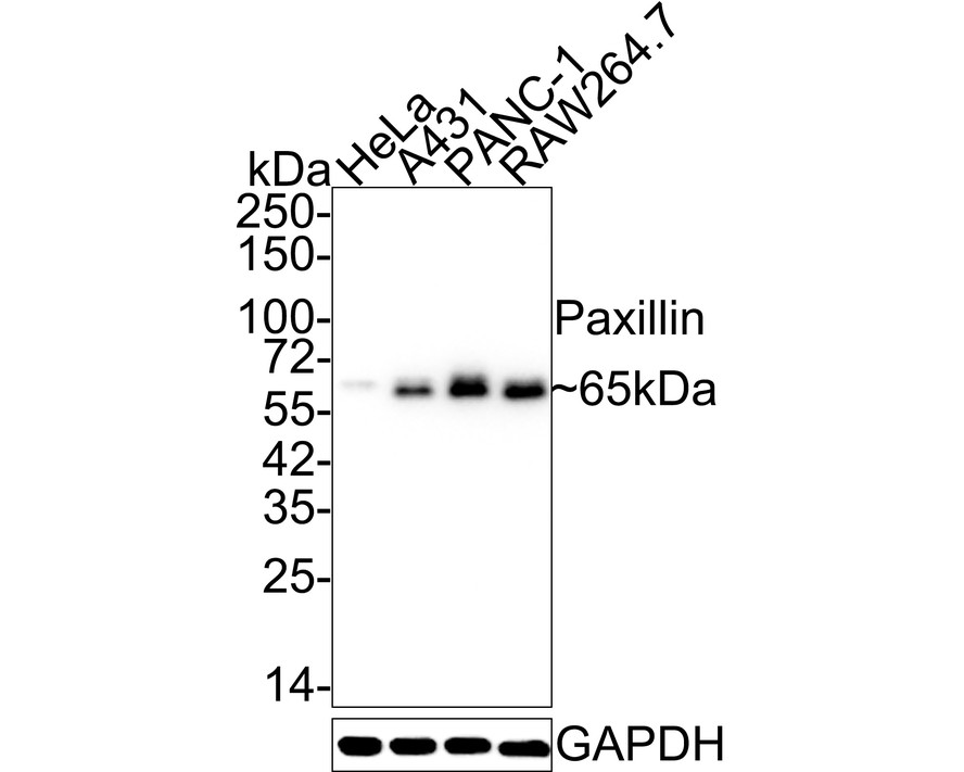 Western blot analysis of Paxillin on different lysates. Proteins were transferred to a PVDF membrane and blocked with 5% BSA in PBS for 1 hour at room temperature. The primary antibody (ET1607-22, 1/500) was used in 5% BSA at room temperature for 2 hours. Goat Anti-Rabbit IgG - HRP Secondary Antibody (HA1001) at 1:5,000 dilution was used for 1 hour at room temperature.<br />
Positive control: <br />
Lane 1: NIH/3T3 cell lysate<br />
Lane 2: A549 cell lysate