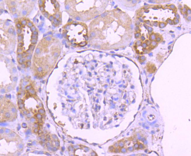 ICC staining of Paxillin in SKOV-3 cells (green). Formalin fixed cells were permeabilized with 0.1% Triton X-100 in TBS for 10 minutes at room temperature and blocked with 1% Blocker BSA for 15 minutes at room temperature. Cells were probed with the primary antibody (ET1607-22, 1/50) for 1 hour at room temperature, washed with PBS. Alexa Fluor®488 Goat anti-Rabbit IgG was used as the secondary antibody at 1/1,000 dilution. The nuclear counter stain is DAPI (blue).