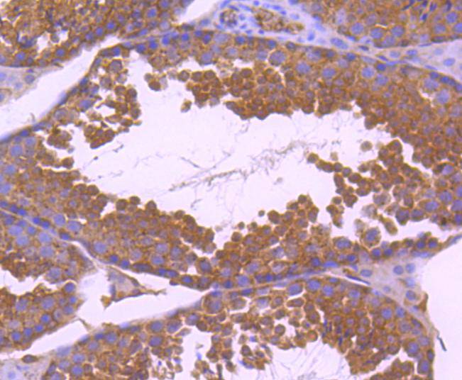 Immunohistochemical analysis of paraffin-embedded human kidney tissue using anti-Paxillin antibody. The section was pre-treated using heat mediated antigen retrieval with Tris-EDTA buffer (pH 8.0-8.4) for 20 minutes.The tissues were blocked in 5% BSA for 30 minutes at room temperature, washed with ddH2O and PBS, and then probed with the primary antibody (ET1607-22, 1/50) for 30 minutes at room temperature. The detection was performed using an HRP conjugated compact polymer system. DAB was used as the chromogen. Tissues were counterstained with hematoxylin and mounted with DPX.